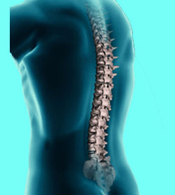 Posterior-Longitudinal-Ligament-Ossification-41 - Spinal Stenosis